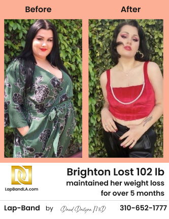 Brighton Before After