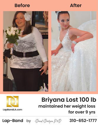 Briyana Before After