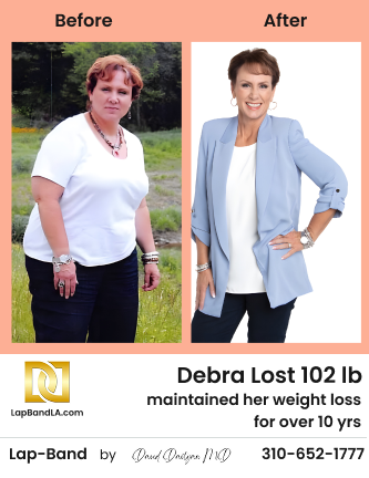 Debra Before After