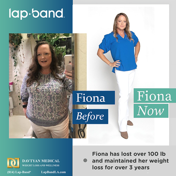 Fiona before after image