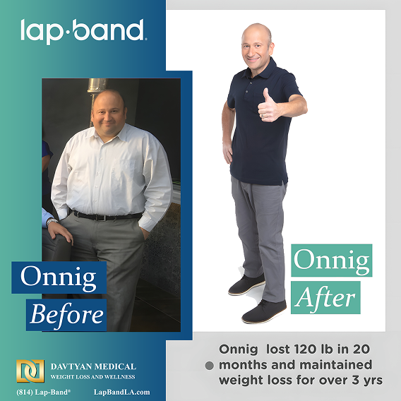 Onnig before after image