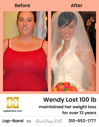 Wendy Before After