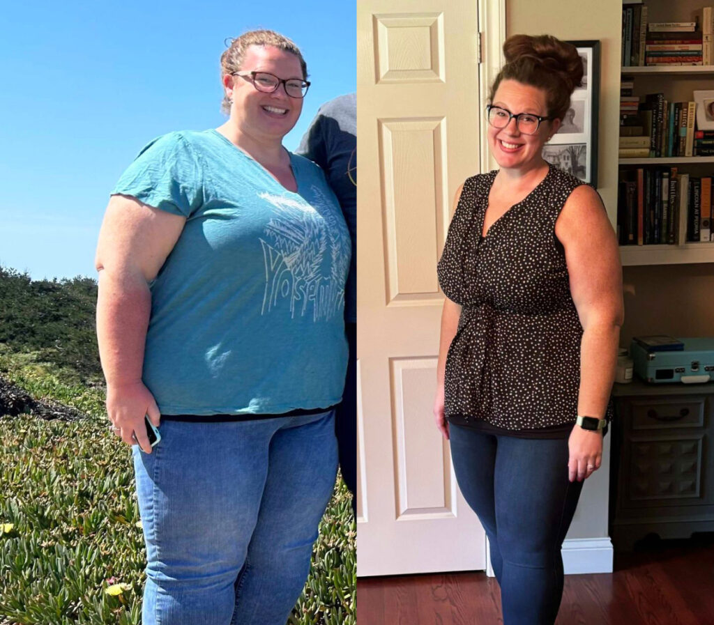 Katie T 107s-lb weight loss with Lap-Band by Sid Rohrscheib, MD