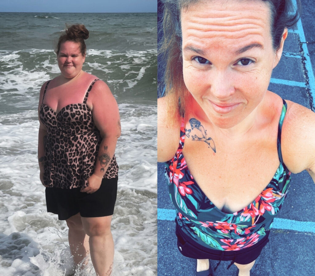 Nicole A 140s-lb weight loss with Lap-Band by John Olsofka, MD, FACS