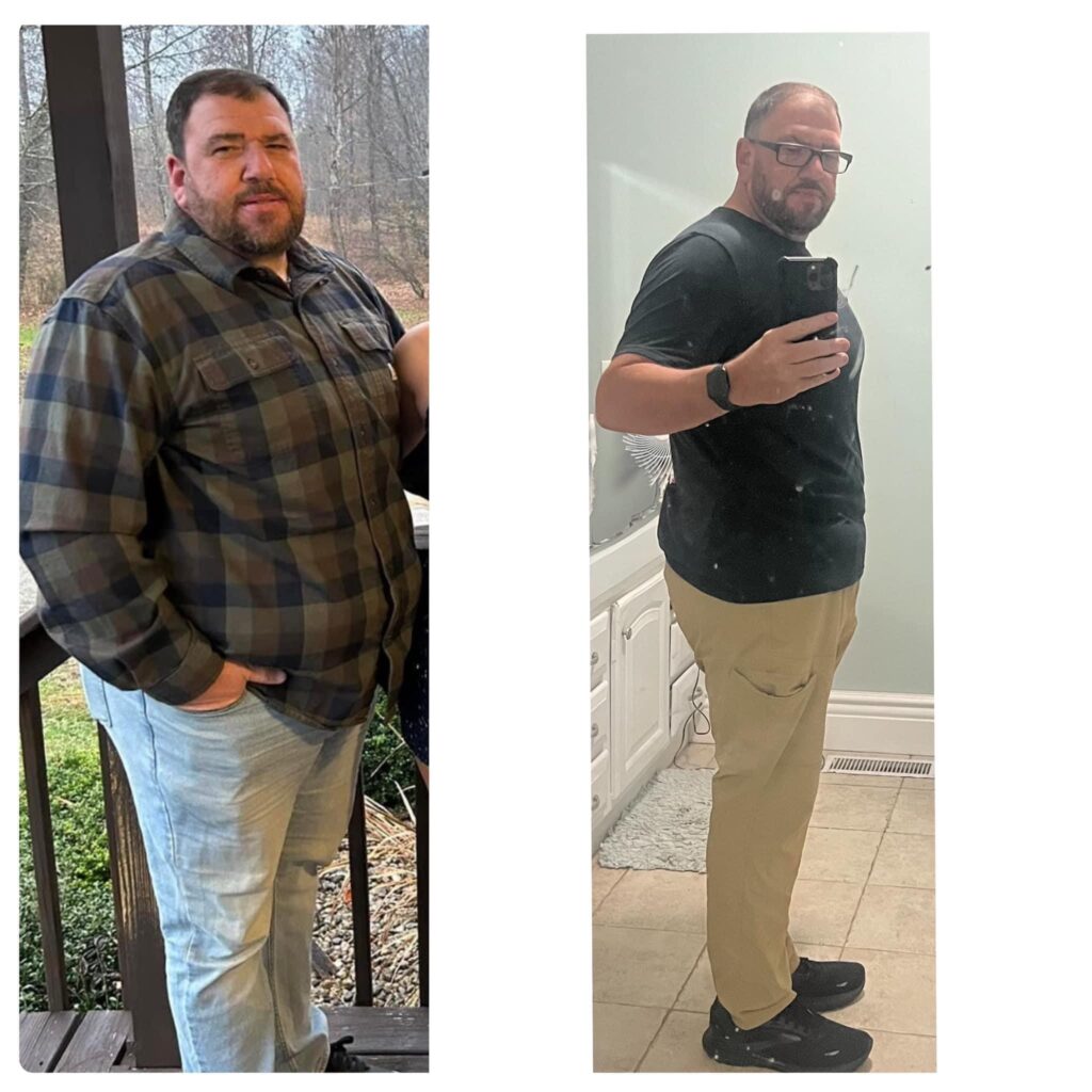 Tracy M 100s-lb weight loss with Lap-Band by John Olsofka, MD, FACS