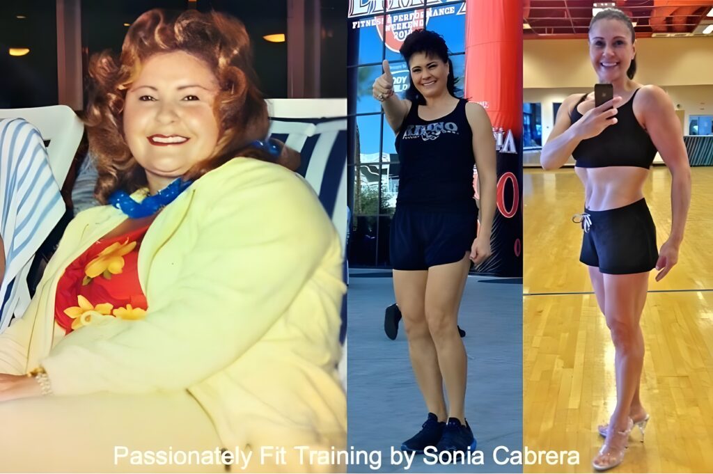 Cabrera 90s-lb weight loss with Lap-Band by David G. Davtyan MD, FACS, FICS